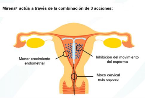 Dra. Gabriela Percossi- Estudios preconcepcionales y ACIDO FOLICO